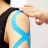 kinesiology taping treatment with blue tape on female patient injured arm. Sports injury kinesio treatment