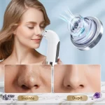 Aparat Vacuum Curatire cu Apa- Reîmprospătare și Întinerire a Pielii biomed.md chisinau moldova
